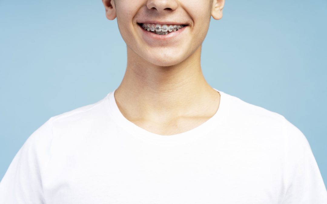Ortodoncia en Almería para adolescentes